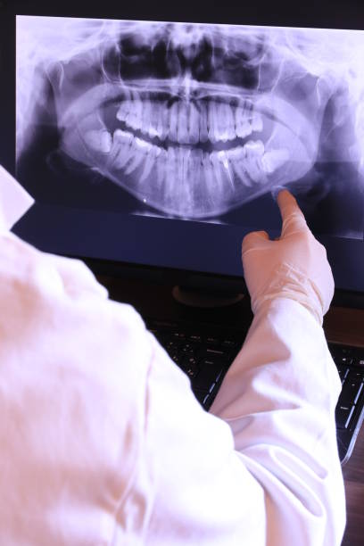 Best Emergency Dental Care for Broken or Chipped Teeth in Lorado Springs, CO