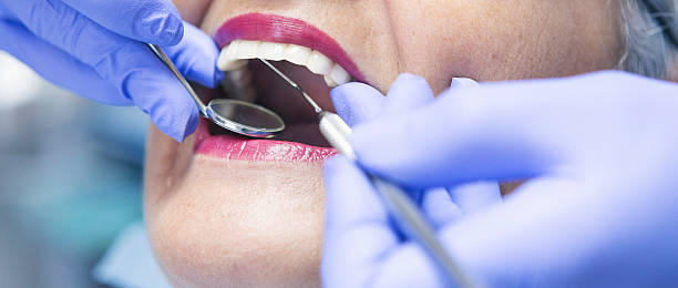 Best Emergency Dental Care for Broken or Chipped Teeth in Lorado Springs, CO